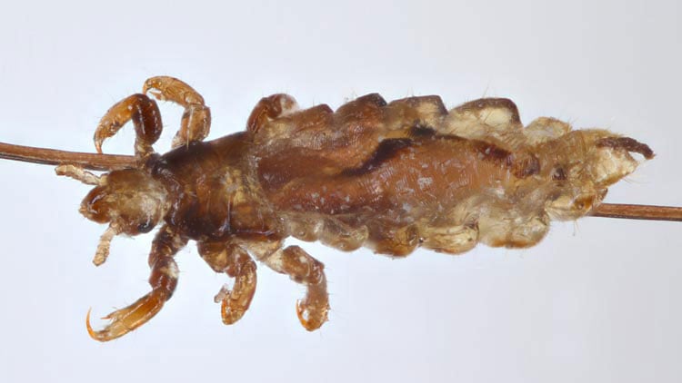Nahaufnahme Kopflaus
